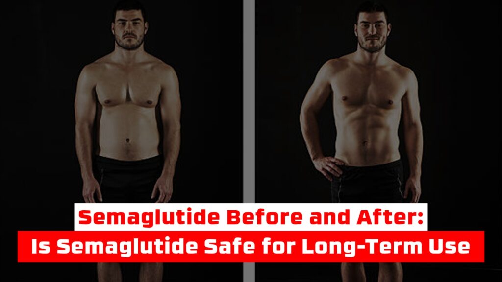 Semaglutide Before and After: Is Semaglutide Safe for Long-Term Use