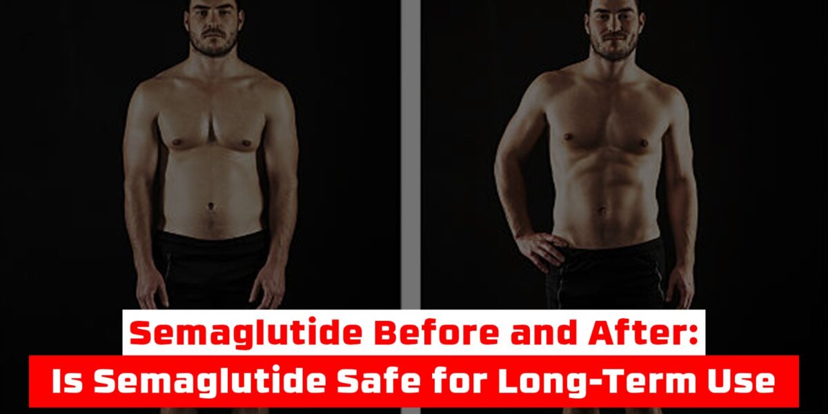 Semaglutide Before and After: Is Semaglutide Safe for Long-Term Use