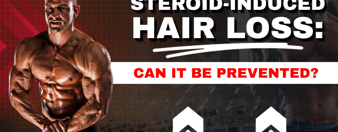 Steroid-Induced Hair Loss