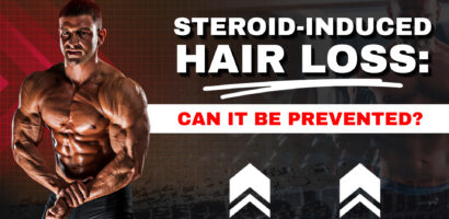 Steroid-Induced Hair Loss