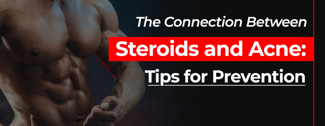 Steroids and Acne Prevention