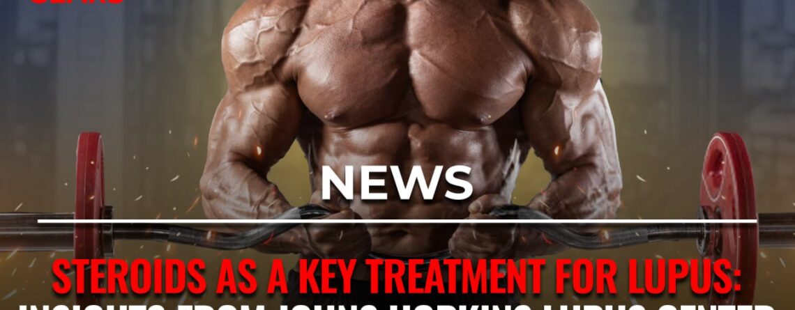 Steroids for Lupus Treatment