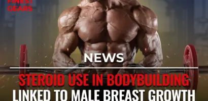 Man with gynecomastia caused by steroid use in bodybuilding